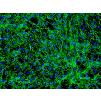 人体皮肤成纤维细胞-新生儿 (HDF-n) - 纤连蛋白免疫染色，200x.