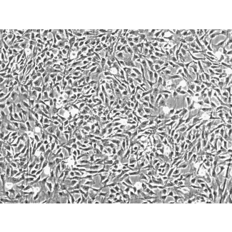 人类关节软骨细胞 (HC-a) - 相差显微镜，100倍放大。