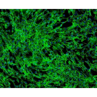 人类头发内根鞘细胞（HHIRSC）- 纤维连接蛋白免疫染色，100倍显微镜观察