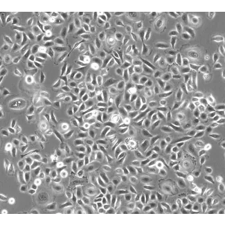 人类小气道上皮细胞（HSAEpiC）- 相差显微镜 100x