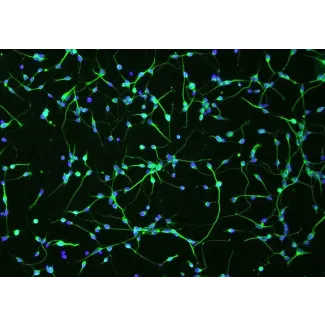 人类少突胶质前体细胞（HOPC）– A2B5免疫染色，100倍放大。