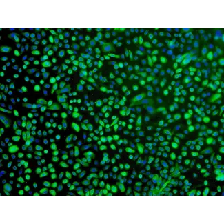 <p>人类支气管上皮细胞（HBEpiC）- CK-18免疫染色，100倍。</p>