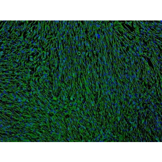 人类支气管成纤维细胞 (HBF) - 纤维连接蛋白免疫染色，100倍