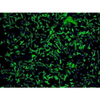 小脑星形胶质细胞 (HA-c) - GFAP 免疫染色，100x。