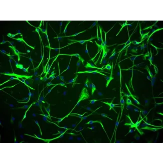 人类星形胶质细胞-海马（HA-h）- GFAP免疫染色，200倍放大。
