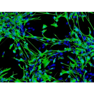 人类星形胶质细胞-脑干（HA-bs）- GFAP免疫染色，100倍放大。