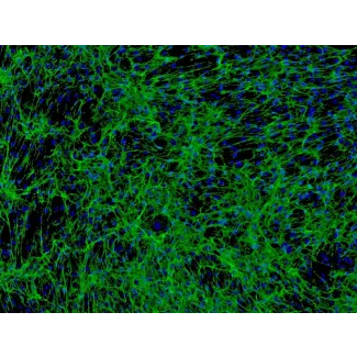 人类毛发外根鞘细胞 (HHORSC) - 纤维连接蛋白免疫染色，100x。