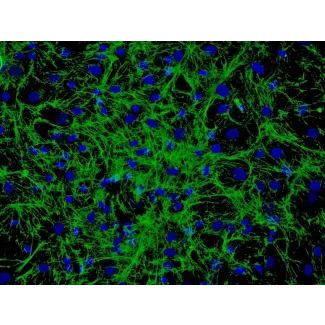 人类毛发生殖基质细胞 (HHGMC) - 纤维连接蛋白免疫染色，200x。