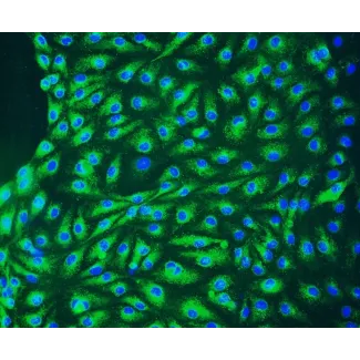人类淋巴内皮细胞（HLEC）- vWF 免疫染色，200倍显微镜观察