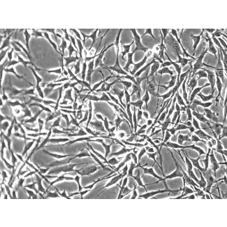 人类滑膜细胞（HS） - 相差显微镜，200倍。