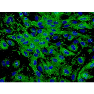 人类真皮微血管内皮细胞 (HDMEC) - vWF 免疫染色，400x。