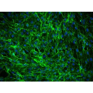 人类真皮成纤维细胞-胎儿 (HDF-f) - 纤维连接蛋白免疫染色，200倍