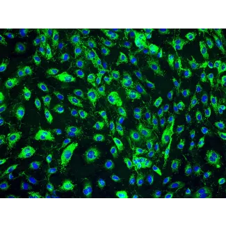 人类真皮淋巴内皮细胞 (HDLEC) - vWF 免疫染色，200x。