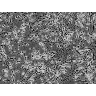 人类海马神经元 (HN-h) - 相差显微镜，200倍。