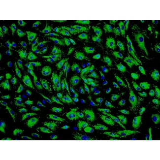 人类肺毛细血管内皮细胞 (HPMEC) - vWF 免疫染色, 200倍