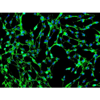 人类肺成纤维细胞（HPF）- 纤维连接蛋白免疫染色，200倍。