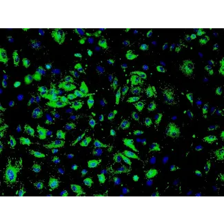 人类肾小球内皮细胞（HRGEC）- 免疫染色，标记 vWF，200倍显微镜放大。
