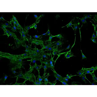 人类肾小管系膜细胞 (HRMC) - 纤维连接蛋白免疫染色，200倍。