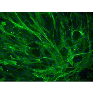 人类膀胱平滑肌细胞（HBdSMC）- α-SMA免疫染色，200倍。