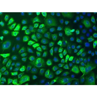 人类表皮角质形成细胞-成人 (HEK-a) - CK-18 免疫染色，100x。