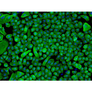 人类表皮角质形成细胞-新生儿 (HEK-n) - CK-18 免疫染色，200x。