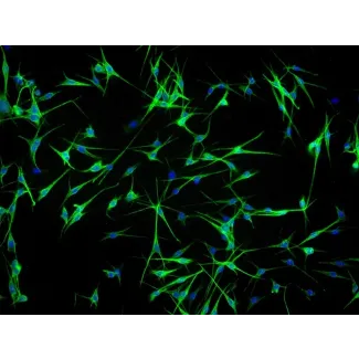 人类表皮黑素细胞-成人 (HEM-a) - S100-β免疫染色，100倍