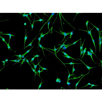 人类表皮黑素细胞-黑色 (HEM-d) - 波形蛋白免疫染色，200倍