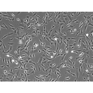 人类视网膜星形胶质细胞（HRA）- 相差显微镜，100倍放大。