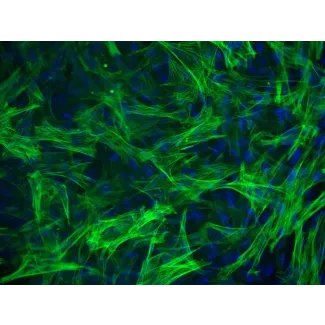 人类食管平滑肌细胞（HESMC）- α-SMA免疫染色，200倍。