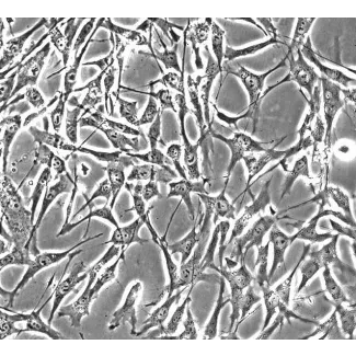 人类骨骼肌卫星细胞 (HSkMSC) - 相差显微镜，200倍