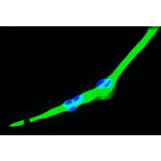 人类骨骼肌细胞 (HSkMC) - 肌球蛋白免疫染色，400倍