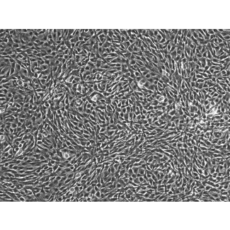 人类骨骼肌肌母细胞（HSkMM）- 相差显微镜，100倍