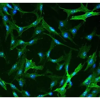 人类肝星状细胞（HHSteC） - α-平滑肌肌动蛋白免疫染色，400倍放大。
