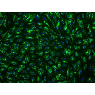 人肝窦内皮细胞（HHSEC）—vWF免疫染色，200X
