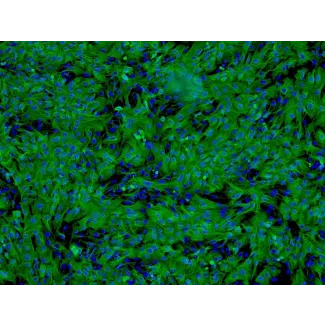 人肝细胞 (HH) - 针对细胞角蛋白-18 (CK-18) 的免疫染色，100倍。