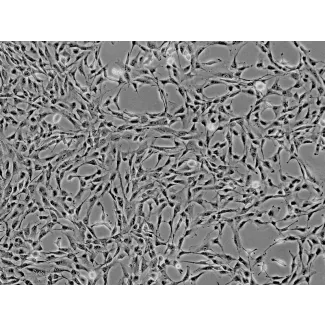 人肝脏间充质干细胞（HMSC-he）—— 相差显微镜，100×。