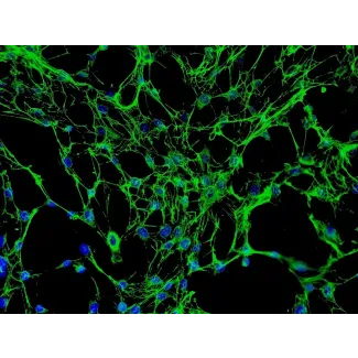 人类股骨成骨细胞（HO-f）- 免疫染色标记纤维连接蛋白，200倍。