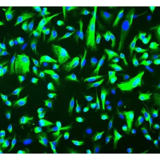人肾上皮细胞（HREpiC）- CK-18 的免疫染色，200倍。