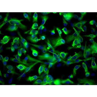 人肾近曲小管上皮细胞（HRPTEpiC） - CK-18 免疫染色，200 倍放大。