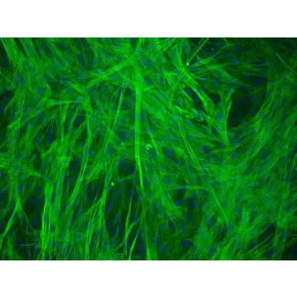 人胃平滑肌细胞（HGSMC） - α-平滑肌肌动蛋白（α-SMA）免疫染色，200倍放大。