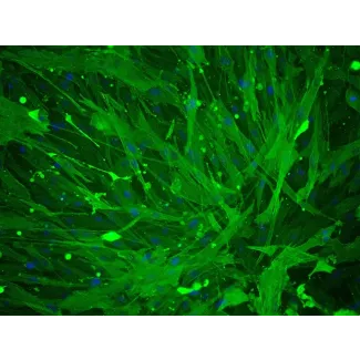 人脐动脉平滑肌细胞（HUASMC）- α-SMA免疫染色，200倍。
