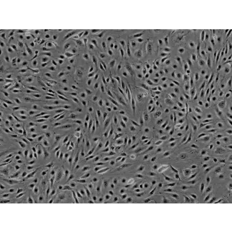 人脑微血管内皮细胞（HBMEC） - 相差显微镜, 100倍。
