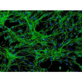 人脑膜细胞 (HMC) - 纤连蛋白免疫染色，200倍。