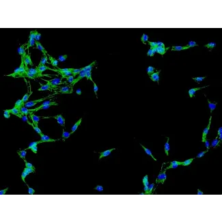 人脑血管外膜成纤维细胞（HBVAF）- 免疫染色纤维连接蛋白，200倍。