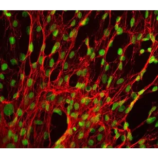 人脾成纤维细胞（HSF）- 纤连蛋白免疫染色，400x。