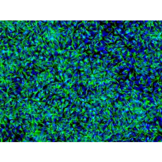 HiPSC 来源的神经干细胞（HiPSC-NSC）- Nestin 免疫染色，200 倍放大