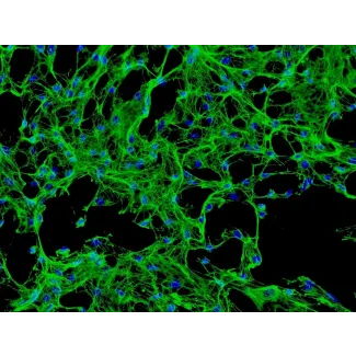 人颅骨成骨细胞（HCO） - 纤维连接蛋白免疫染色，200 倍放大。