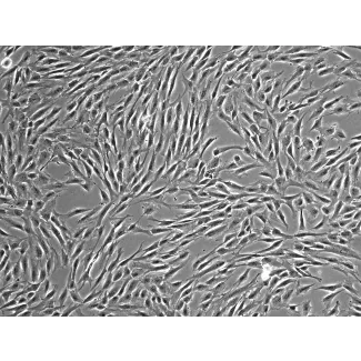 人骨髓间充质干细胞（HMSC-bm）—— 相差显微镜，100×