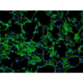 成人真皮成纤维细胞（HDF-a） - 纤维连接蛋白免疫染色，200倍放大。