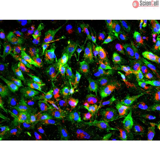 人多能干细胞衍生周细胞（HPSC-P）- NG2（绿色）和PDGFRβ（红色）免疫染色，200倍（200×）